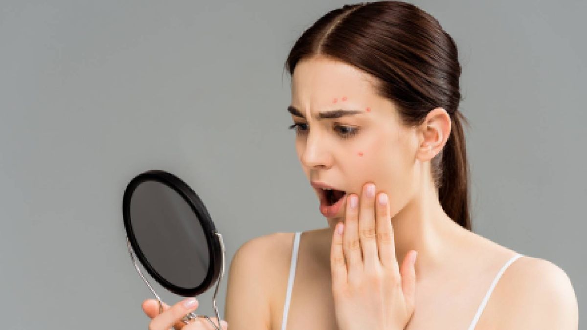 Deal With Seasonal Acne