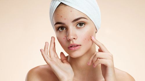 3 Tips For Pimple Marks Removal At Home