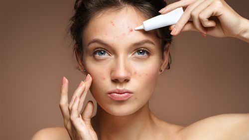 5 Expert Tips To Avoid Seasonal Acne